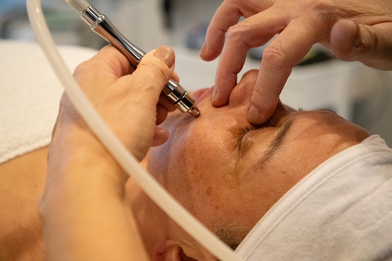 diamantslibning-microdermabrasion-3a Nærbillede ansigt, hvor Lene Kryger arbejder med microdermabrasion. naturli-behandling.dk